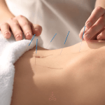 acupuncture for hormone balance